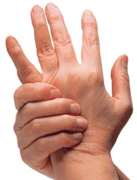 Ehstoday Com Sites Ehstoday com Files Uploads 2013 07 3 Hands Pain Ehstoday Com Sites Ehstoday com Files Uploads 2013 07 3 Hands Pain