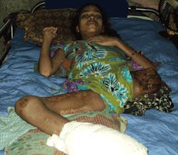 Ehstoday Com Sites Ehstoday com Files Uploads 2013 10 2 Bangladesh Rebek Ehstoday Com Sites Ehstoday com Files Uploads 2013 10 2 Bangladesh Rebek