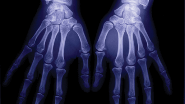 workplace hand protection