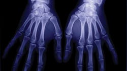 workplace hand protection workplace hand protection