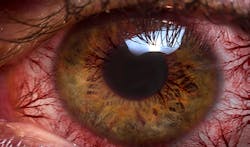 Thinkstock Thinkstock