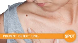 Early detection is key to treating skin cancer. A new video and a campaign urging people to &apos;spot&apos; skin cancer offer life-saving advice.