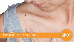 Early detection is key to treating skin cancer A new video and a campaign urging people to quotspotquot skin cancer offer lifesaving advice Early detection is key to treating skin cancer A new video and a campaign urging people to quotspotquot skin cancer offer lifesaving advice