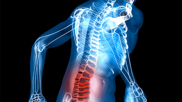 IoT: Reducing Back Injuries and Costs, Improving Productivity