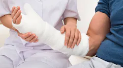 finger amputation