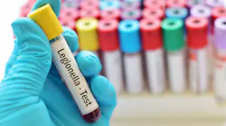 legionella