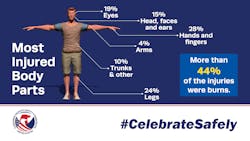 Ehstoday Com Sites Ehstoday com Files Most Injured Body Parts 0 Ehstoday Com Sites Ehstoday com Files Most Injured Body Parts 0