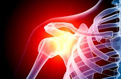 Ehstoday Com Sites Ehstoday com Files Shoulder Xray Raycat Istock Getty 0 Ehstoday Com Sites Ehstoday com Files Shoulder Xray Raycat Istock Getty 0