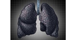 black-lung.jpg black-lung.jpg