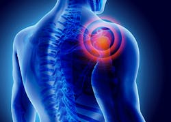 In 2013 overexertion injuries accounted for 244 percent of all nonfatal workplace injuries and amounted to 1508 billion in direct costs These direct costs amount to 290 million dollars per week or 414 million per day In 2013 overexertion injuries accounted for 244 percent of all nonfatal workplace injuries and amounted to 1508 billion in direct costs These direct costs amount to 290 million dollars per week or 414 million per day