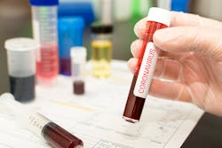 Coronavirus 5e34762054c91 Coronavirus 5e34762054c91