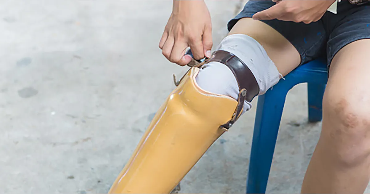 Amputations Osha OSHA Updates Amputation Enforcement | EHS Today