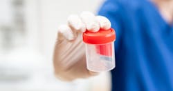 Drug Test Specimen Cup 5f57d5152e248 Drug Test Specimen Cup 5f57d5152e248