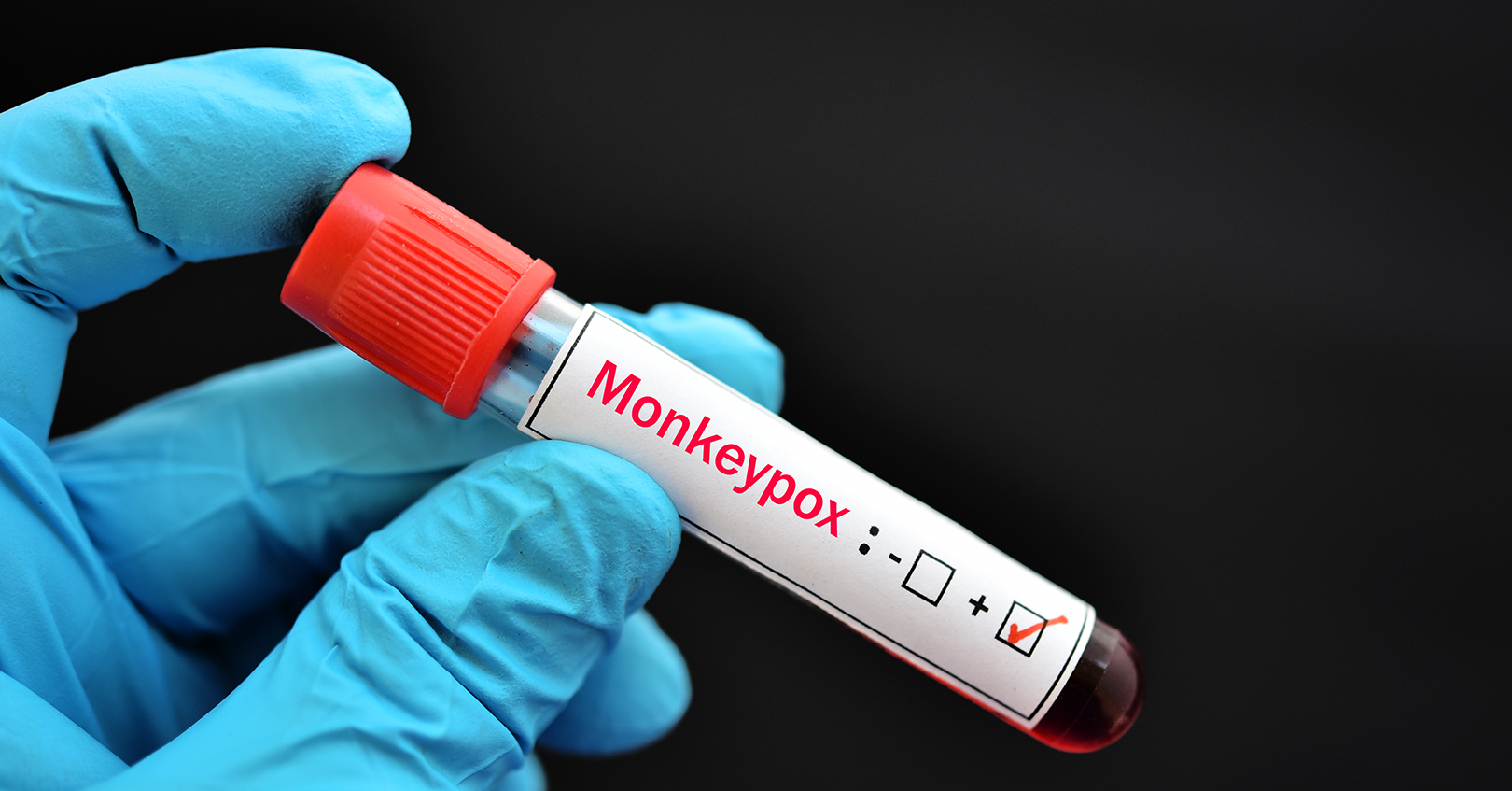 Monkeypox Vaccine In Vial 6324edde01305