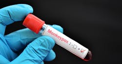 Monkeypox Vaccine In Vial