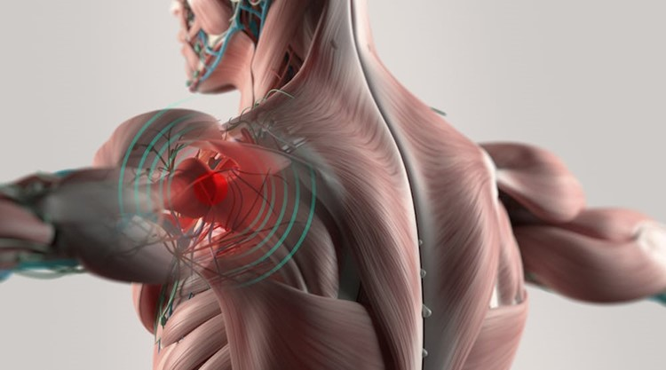 Will a Pledge to Reduce MSD Injuries Lead to Change?