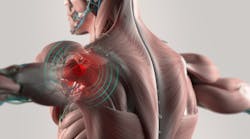 Using Technology to Reduce MSK Injuries Using Technology to Reduce MSK Injuries