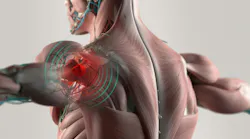 NSC: Progress on Preventing MSD Injuries
