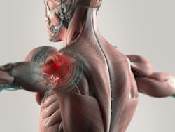NSC: Progress on Preventing MSD Injuries NSC: Progress on Preventing MSD Injuries